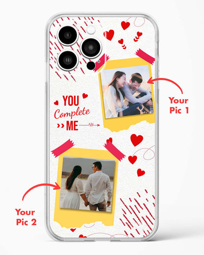 Lovers Custom Photos Clear Silicone Case