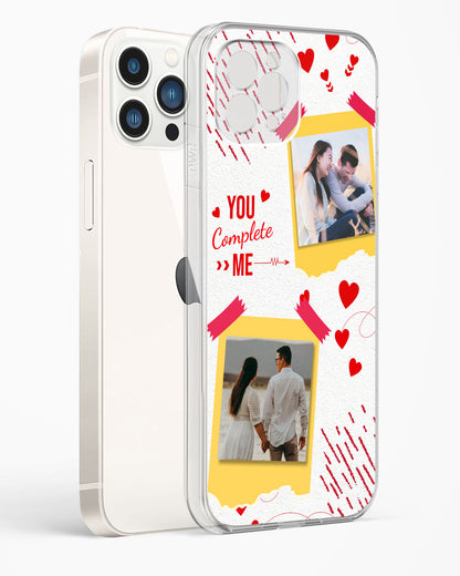 Lovers Custom Photos Clear Silicone Case